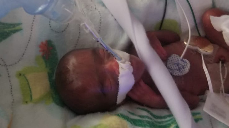 La bebé Saybie estuvo en la unidad de cuidados intensivos neonatales de Sharp Mary Birch durante casi cinco meses recibiendo atención especial.